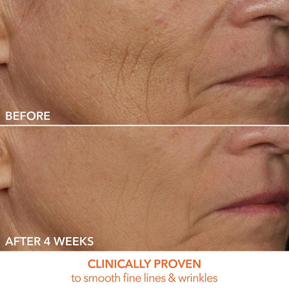 Dr Dennis Gross DRx SpectraLite FaceWare Pro LED Mask - Before and After
