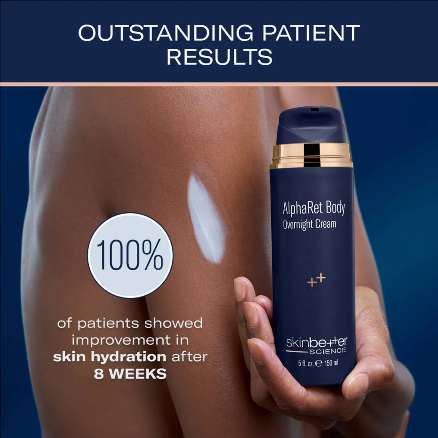Skinbetter AlphaRet Body Overnight Cream 150 mL for gentle overnight skin renewal and hydration.