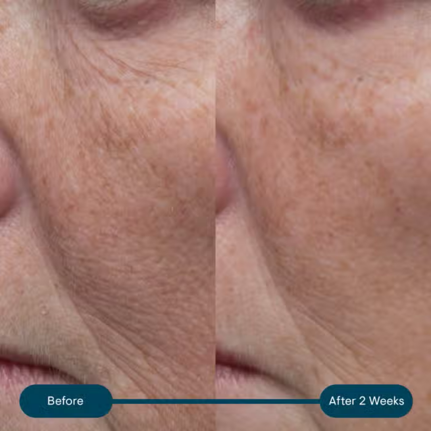 Elemis Pro-Collagen Marine Cream SPF 30 – hydrating anti-aging face cream.