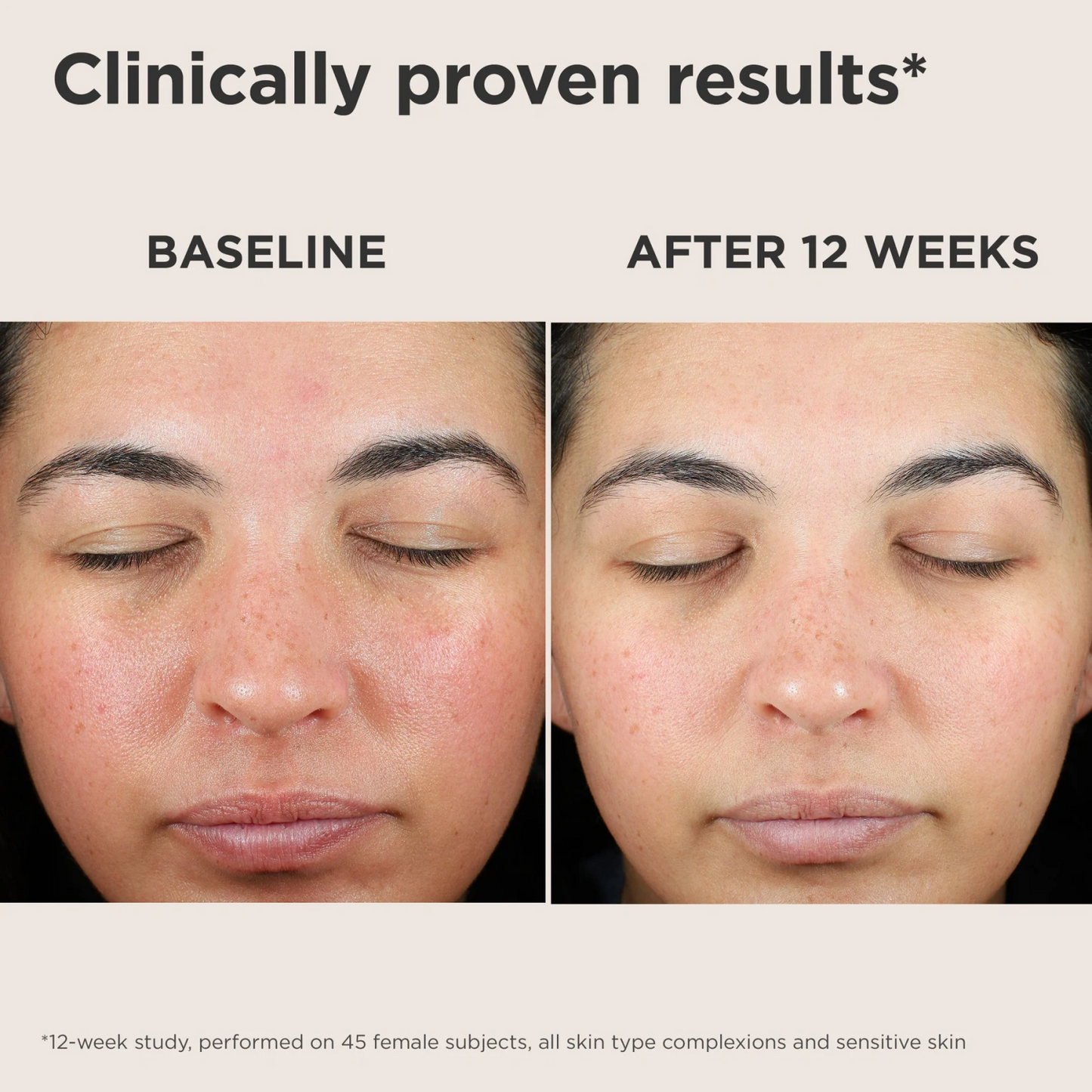 EltaMD UV Skin Recovery SPF 50 with green tint for redness correction and sun protection.