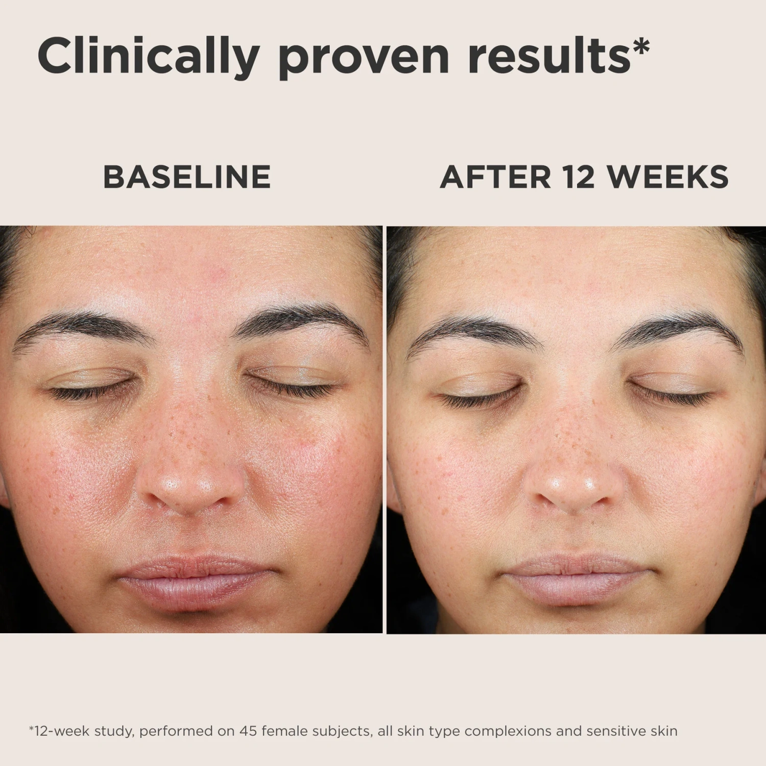 EltaMD UV Skin Recovery SPF 50 with green tint for redness correction and sun protection.