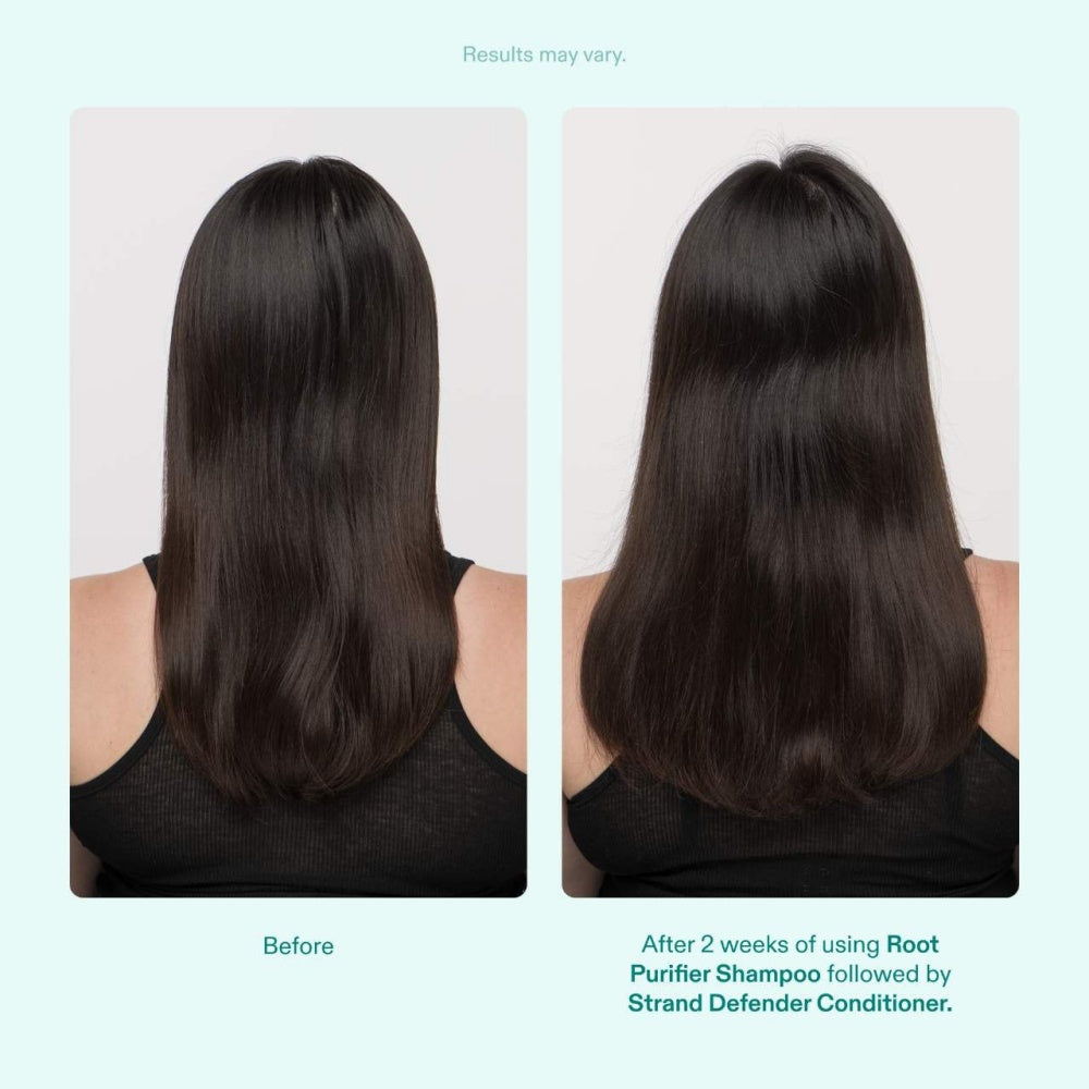 Nutrafol Root Purifier Scalp Microbiome Shampoo packaging.